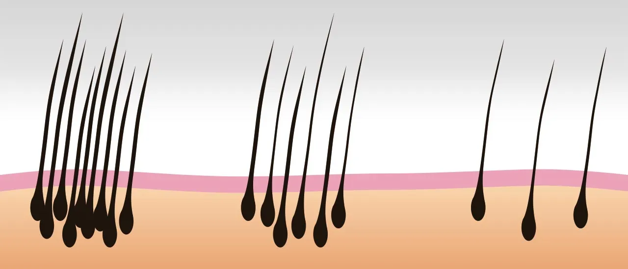 disegno-diradamento-capelli